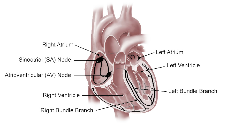 Understanding Atrial Fibrillation University Of Ottawa Heart