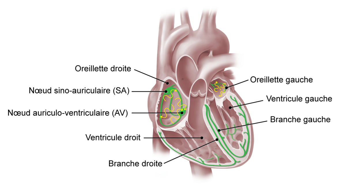 Illustration médicale des sections du coeur montrant les oreillettes, les noeuds, les ventricules et les branches, dans lesquels les impulsions électriques sont irrégulières ou trop rapides en raison de la fibrillation auriculaire.