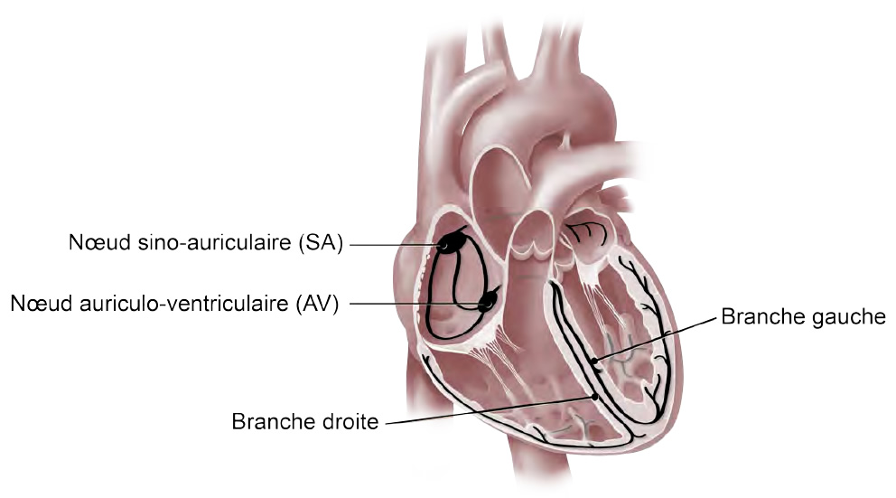 Illustration médicale d'un coeur qui montre le noeud sino-auriculaire, le noeud auriculo-ventriculaire, ainsi que les branches droite et gauche, qui contrôlent les impulsions électriques qui permettent au coeur de battre.