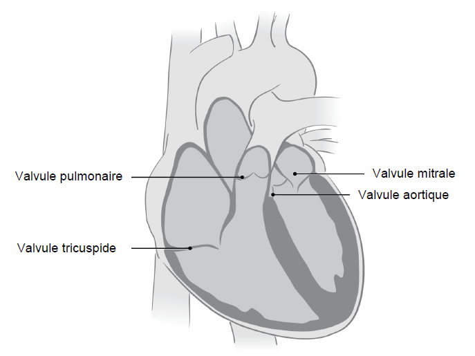 Illustration médicale illustrant les quatre valvules du coeur qui ne se referment pas complètement  lors de la régurgitation mitrale.
