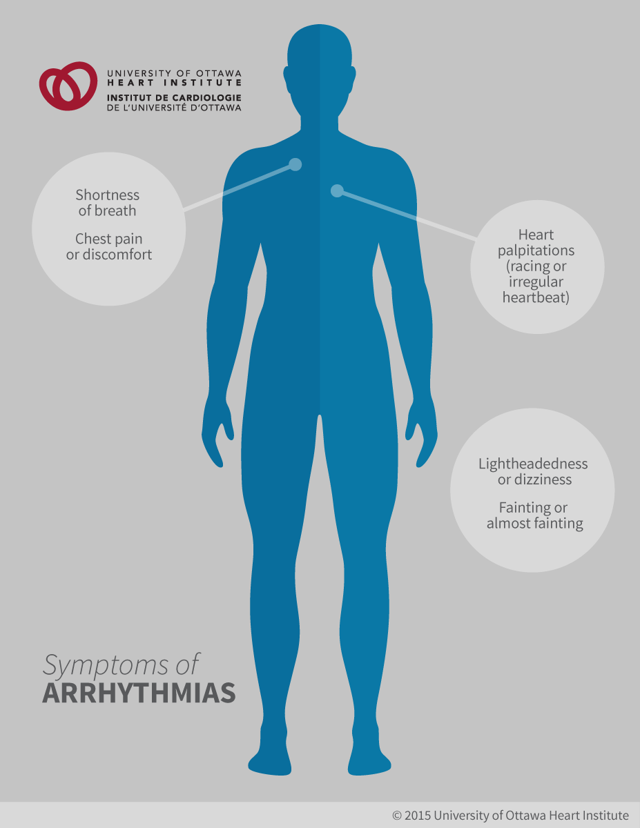 pengpengobatan natural to diseased heart disease arrhythmias