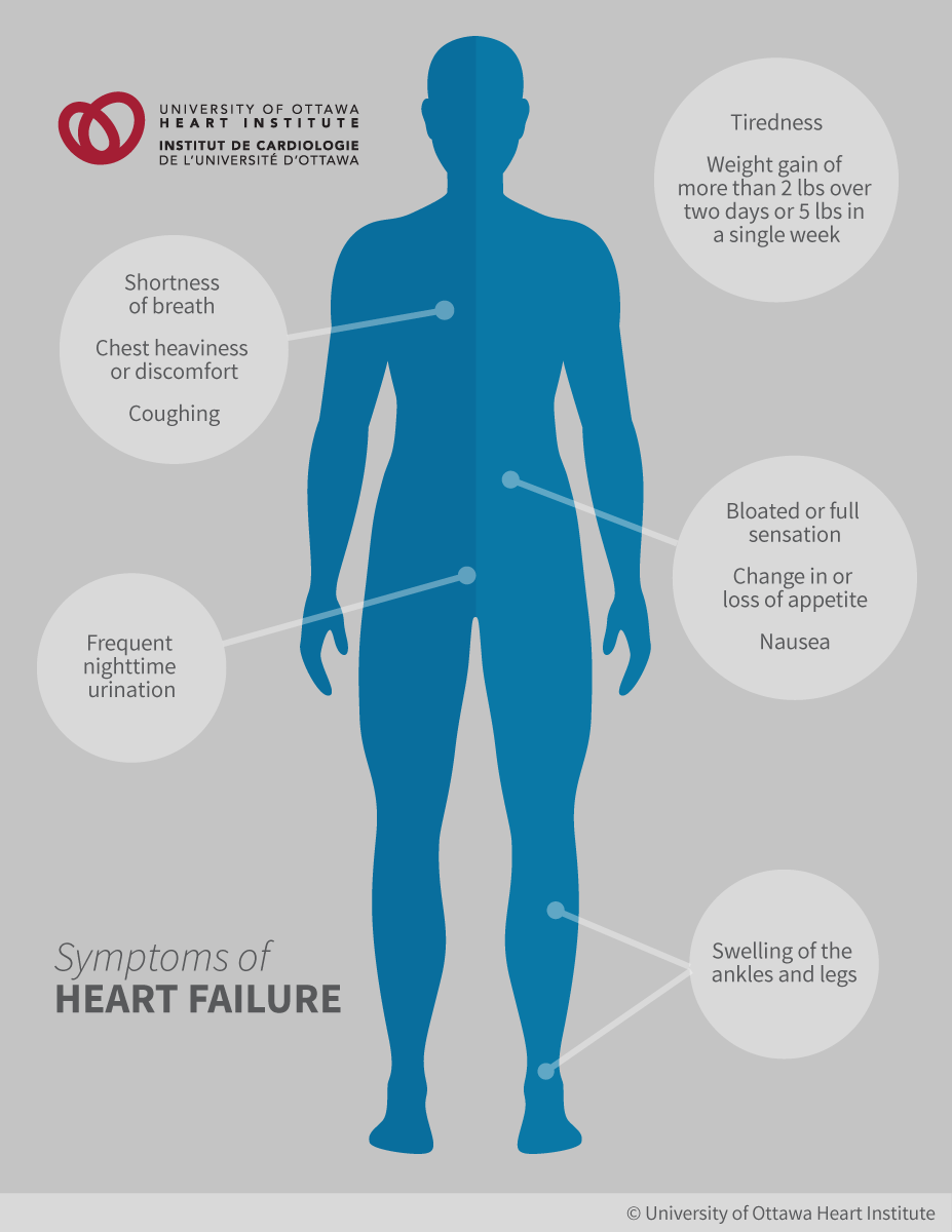 Symptoms of Heart Failure: Feelings of tiredness and weakness, Shortness of breath, which can happen even during mild activity or at night during your sleep, Difficulty breathing while lying down flat, Weight gain from fluid retention; Swelling in the legs, ankles or stomach area