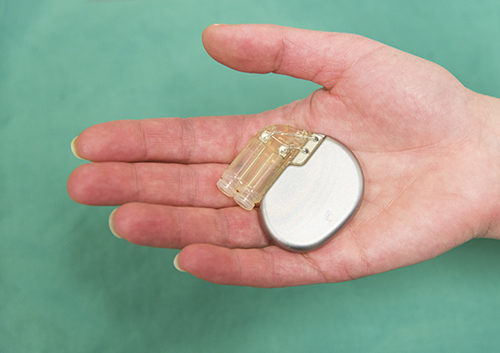 Photo of a pacemaker
