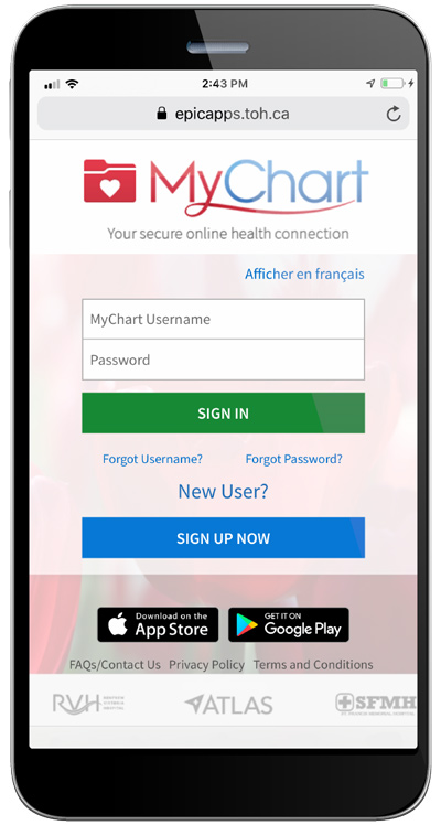 A screen capture illustrating the interface used to login to Epic MyChart from a mobile device.