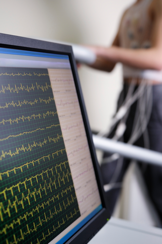 How safe is a cardiac chemical stress test?