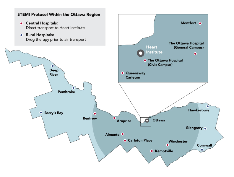Map of STEMI protocol within the Ottawa region