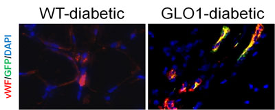 Vascular repair in the ischemic muscle of diabetic mice is superior when a toxic product called methylglyoxal is removed from the tissue (GLO1-diabetic). This is partly because more repair cells are recruited from the bone marrow (yellow).