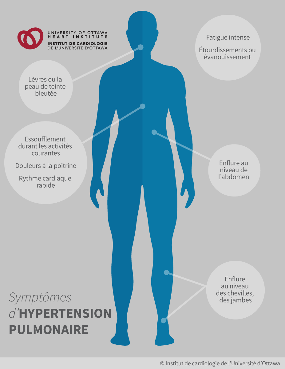 L'hypertension pulmonaire | Institut de cardiologie de l ...