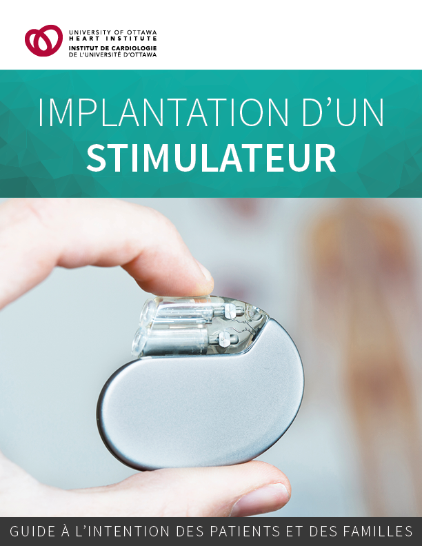 Implantation d’un stimulateur