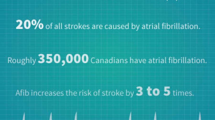 Atrial Fibrillation Facts: The condition affects more than 1% of the population. 20% of all strokes are caused by atrial fibrillation. Roughly 350,000 Canadians have atrial fibrillation. Afib increases the risk of stroke by 3 to 5 times.