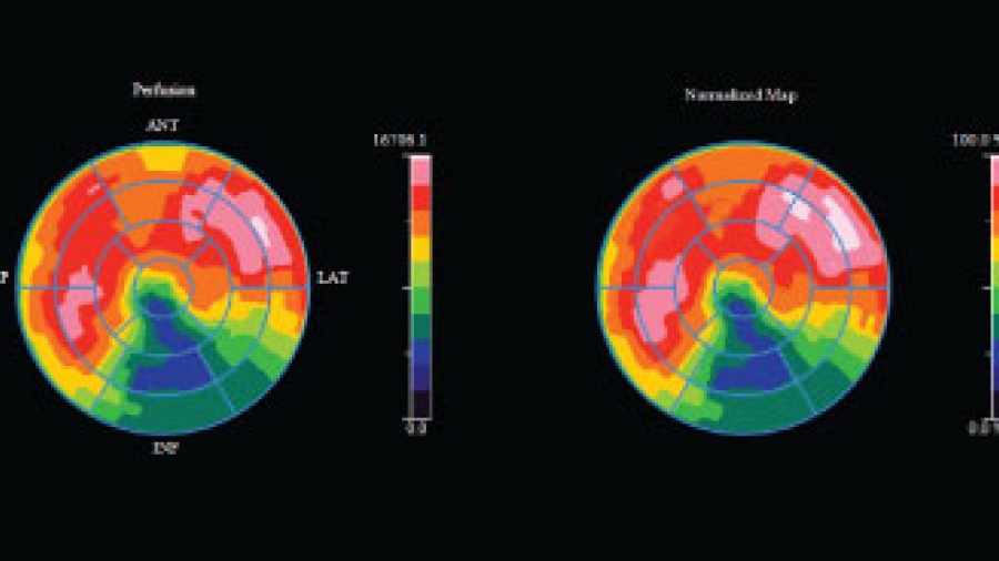 Cardiac imaging technology