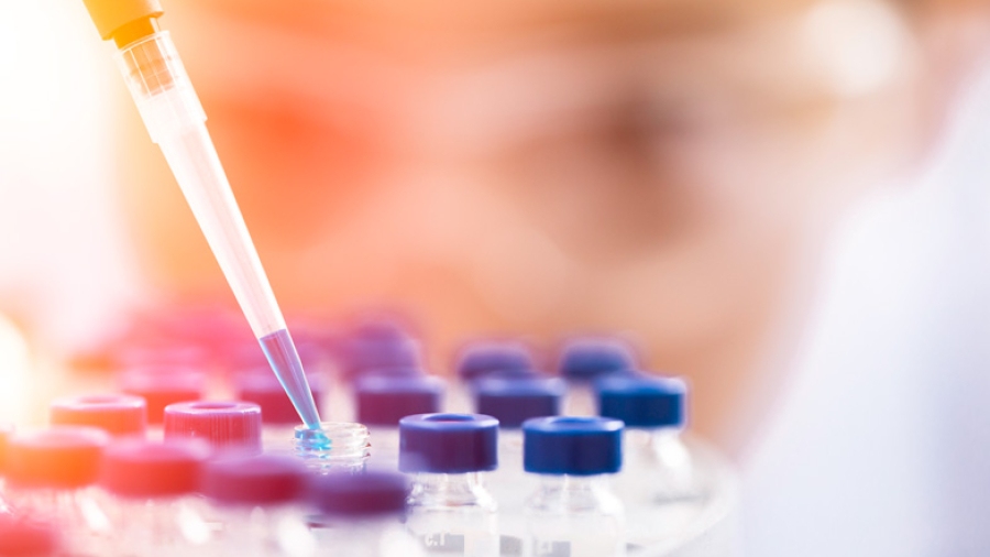 A laboratory technician working with a pipette and test tubes.