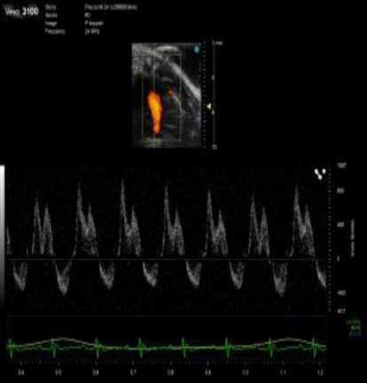 Doppler US of mouse heart
