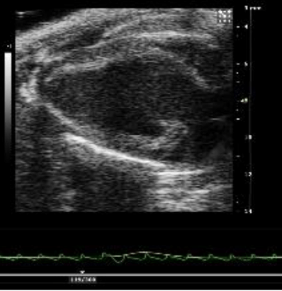 Long axis view of mouse heart