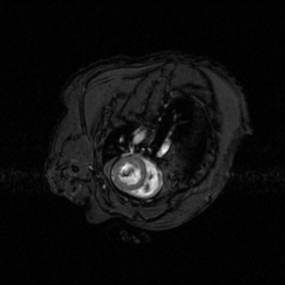 MRI of mouse heart