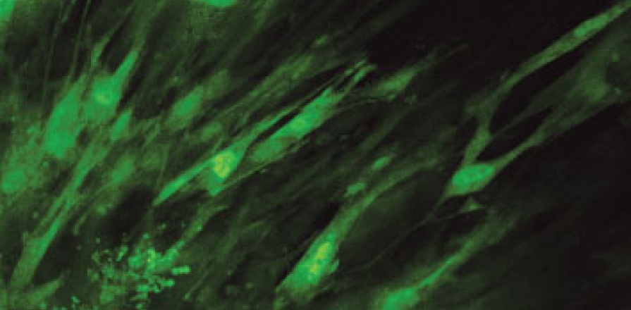 Des cellules progénitrices cardiaques (en vert) sont produites en culture à partir de tissu cardiaque de souris (en bas à gauche) au laboratoire du Dr Darryl Davis.