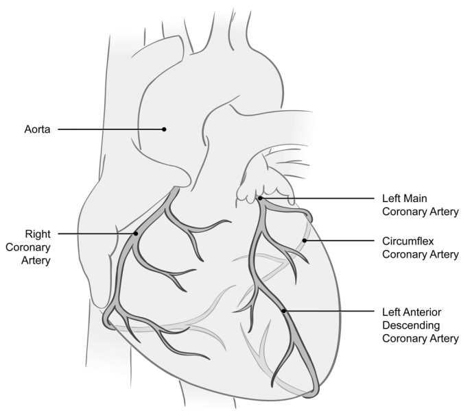 Medical illustration of a heart showing the aorta, right coronary artery, left main coronary artery, circumflex coronary artery and left anterior descending coronary artery. Your doctor will use this illustration to show you what was done during your procedure.
